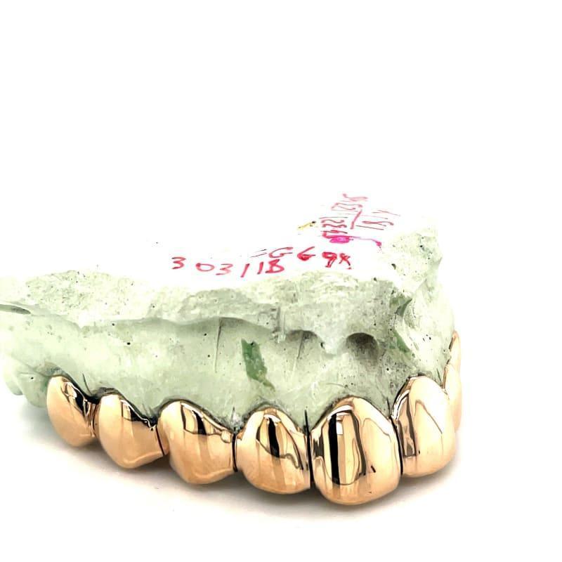 10pc Gold Perm Cut Grillz - Seattle Gold Grillz