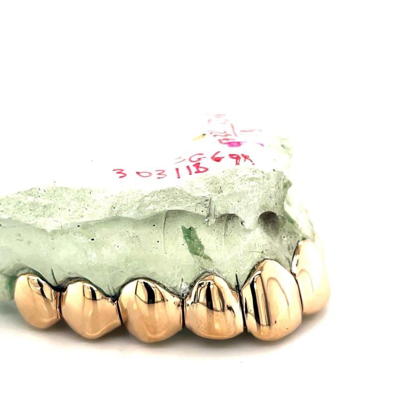 10pc Gold Perm Cut Grillz - Seattle Gold Grillz