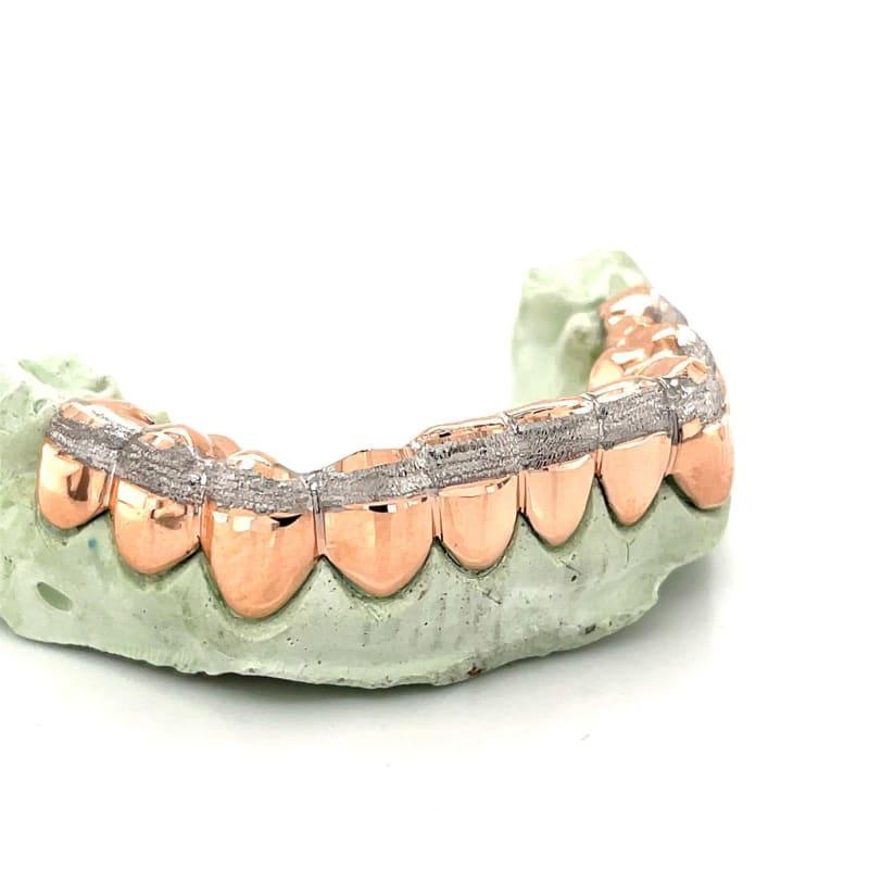 10pc Rose Gold Dusted Grillz - Seattle Gold Grillz
