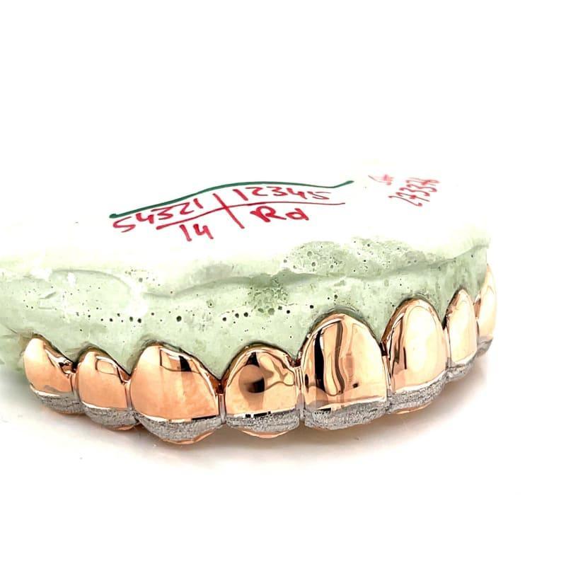 10pc Rose Gold Dusted Grillz - Seattle Gold Grillz