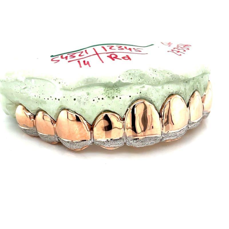10pc Rose Gold Dusted Grillz - Seattle Gold Grillz