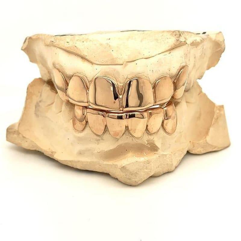 12pc Rose Gold Grillz Set - Seattle Gold Grillz