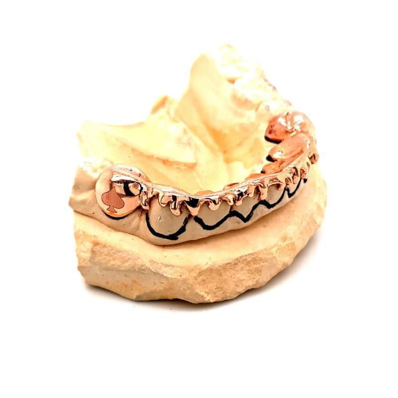 14pc Rose Gold Letters Grillz - Seattle Gold Grillz