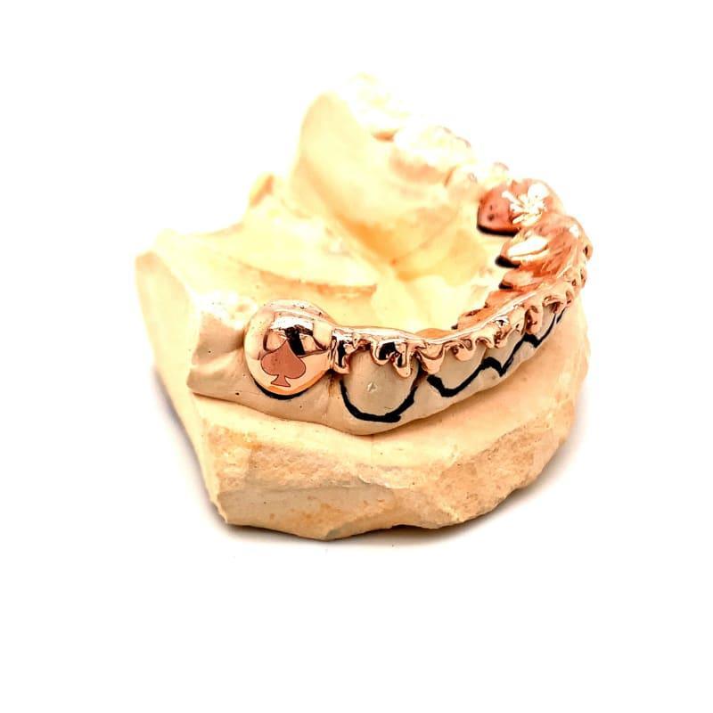 14pc Rose Gold Letters Grillz - Seattle Gold Grillz