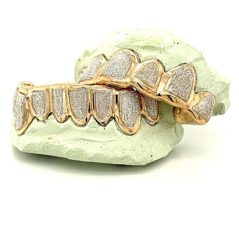 16pc Two Tone Shield Grillz - Seattle Gold Grillz