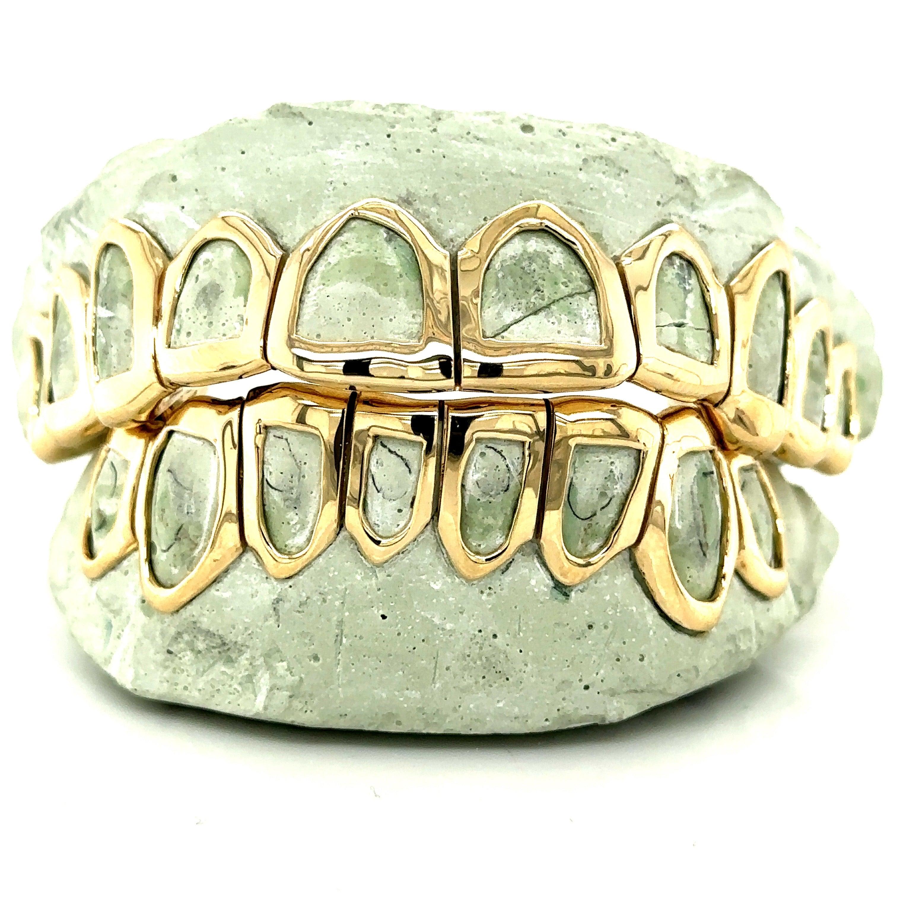 18pc Gold Open Face Grillz - Seattle Gold Grillz