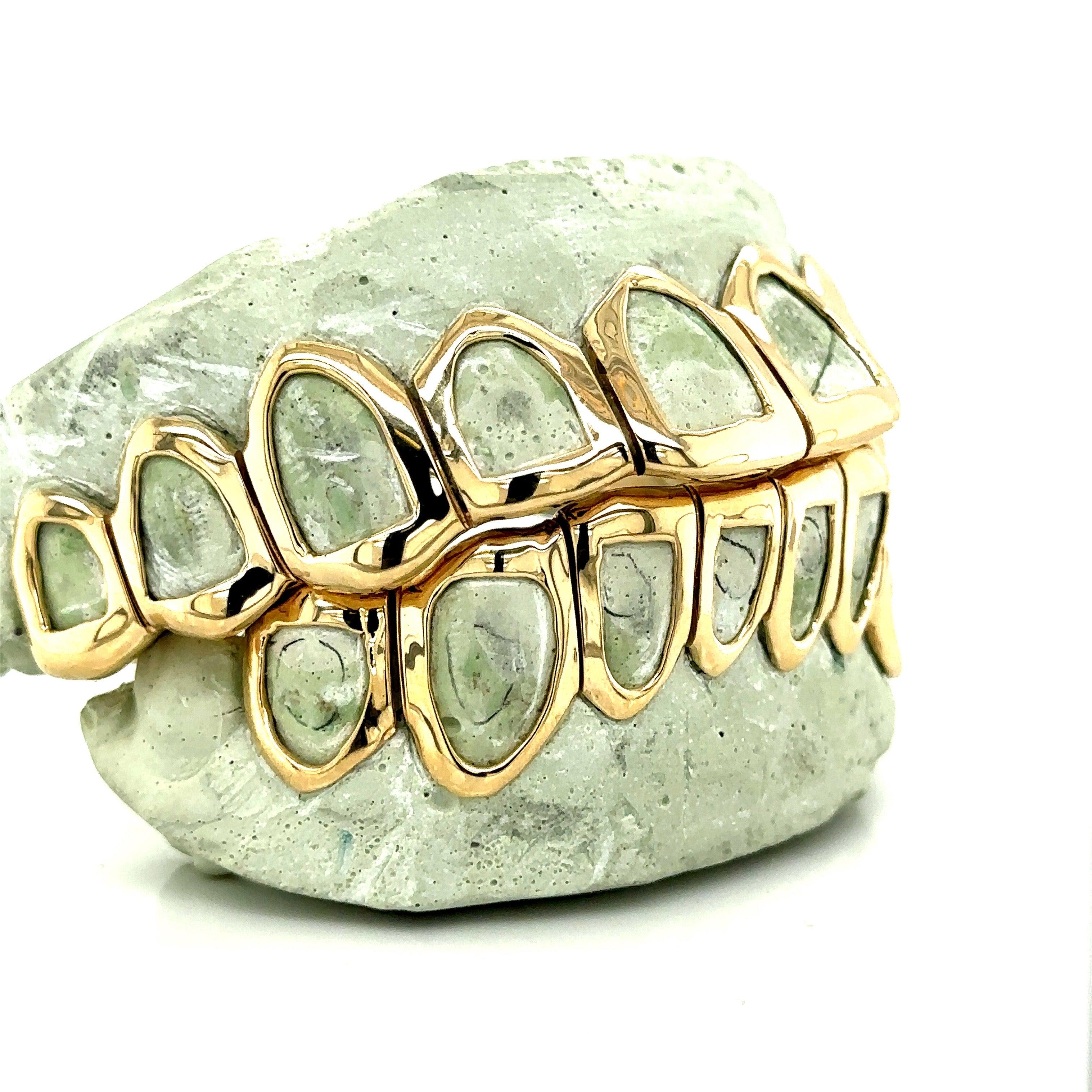 18pc Gold Open Face Grillz - Seattle Gold Grillz