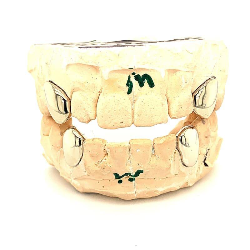 2 Top 2 Bottom White Gold Fangs - Seattle Gold Grillz