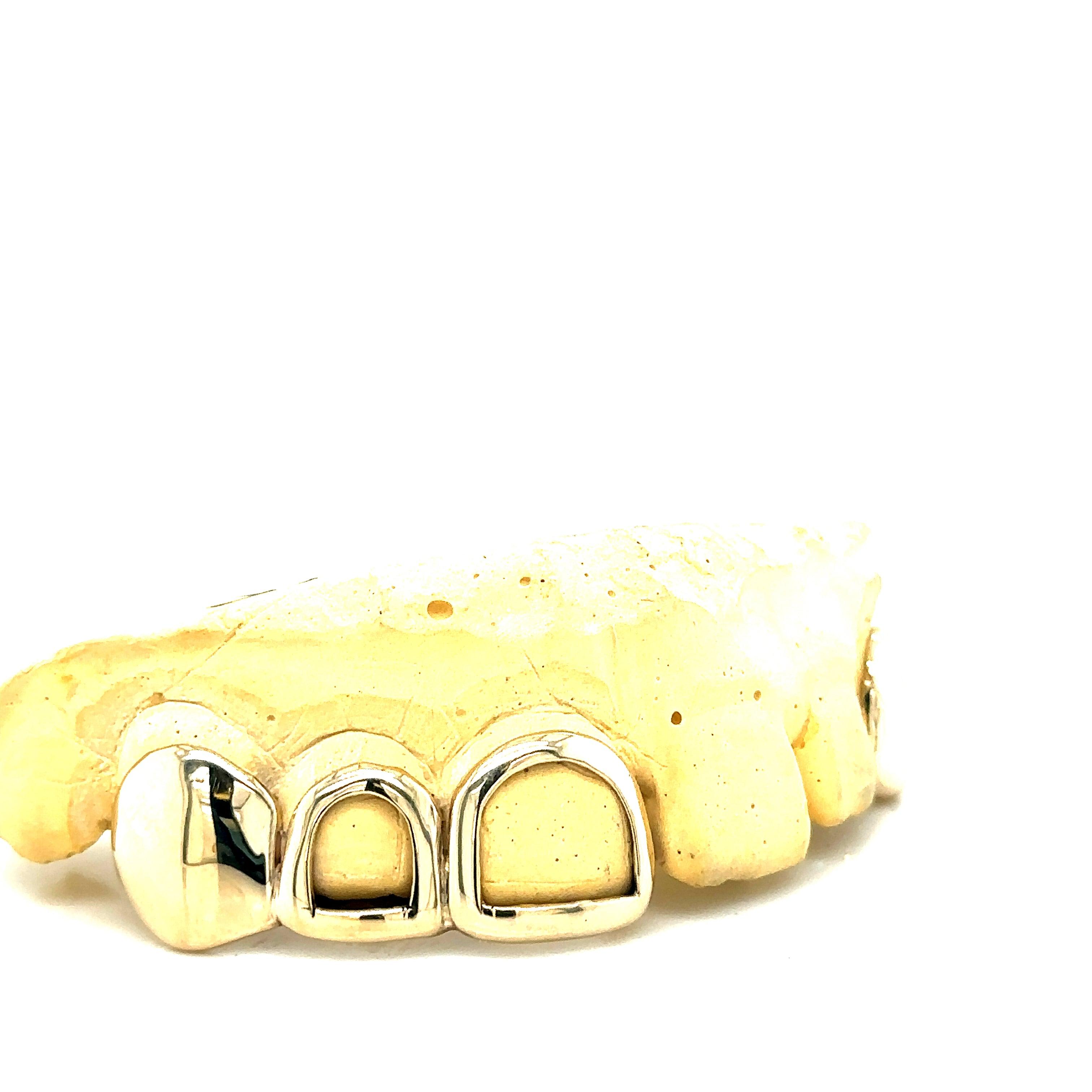 4pc Gold Open Face Top Grillz