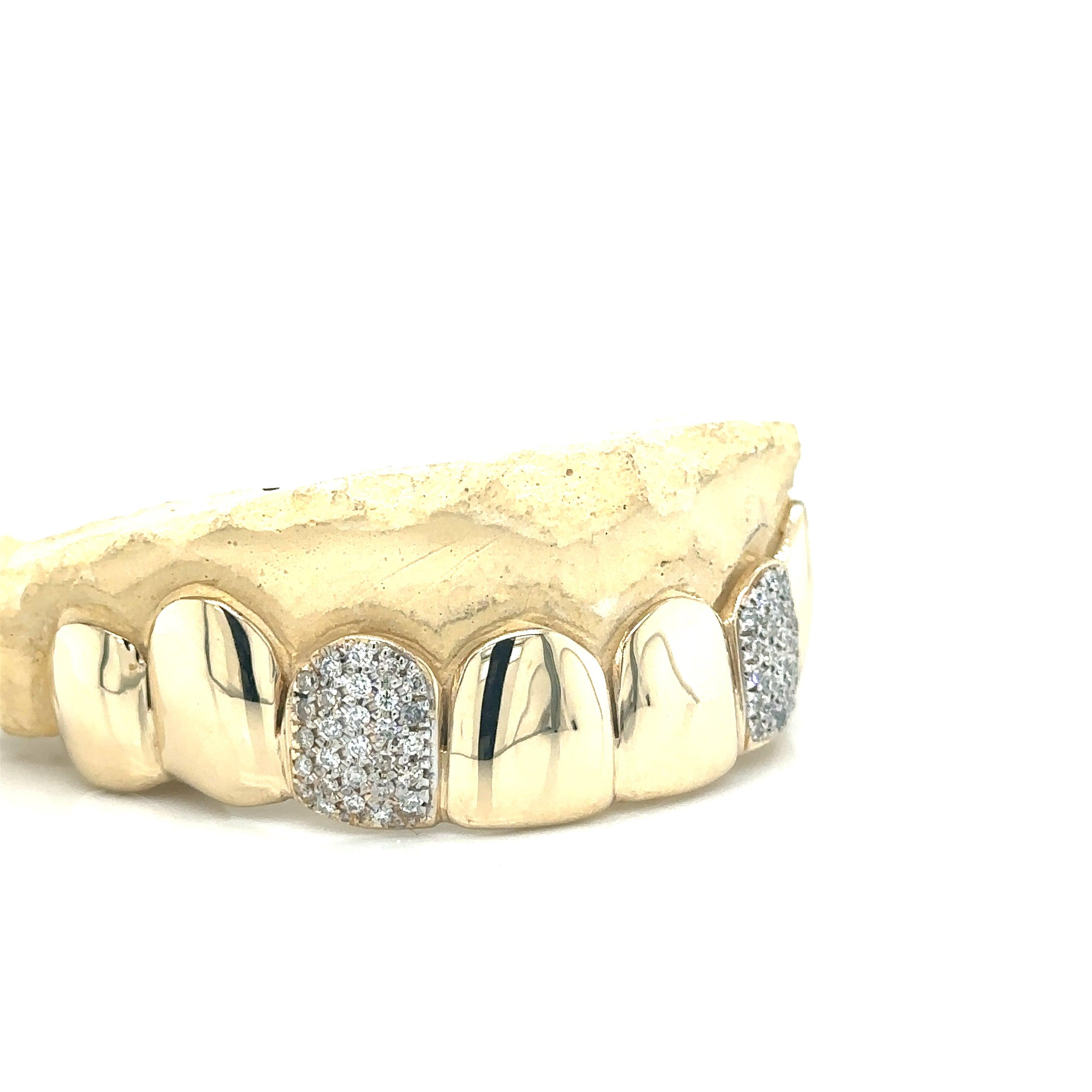 8pc Gold Diamond Incisor Top Grillz