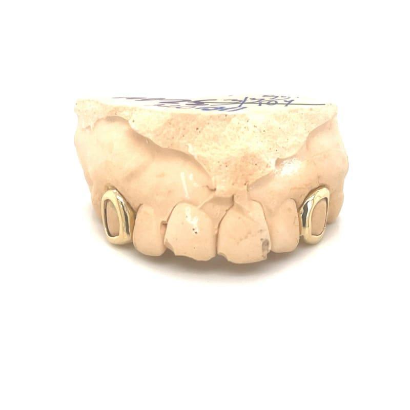 2pc Gold Open Face Top Grillz - Seattle Gold Grillz