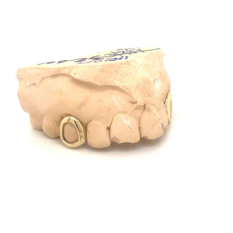 2pc Gold Open Face Top Grillz - Seattle Gold Grillz