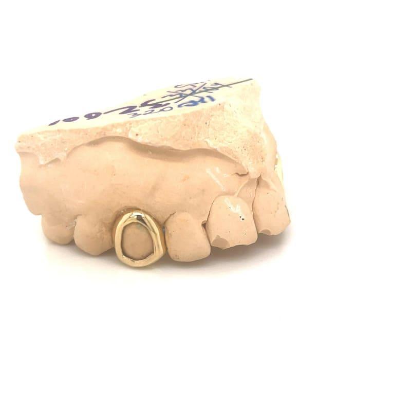 2pc Gold Open Face Top Grillz - Seattle Gold Grillz