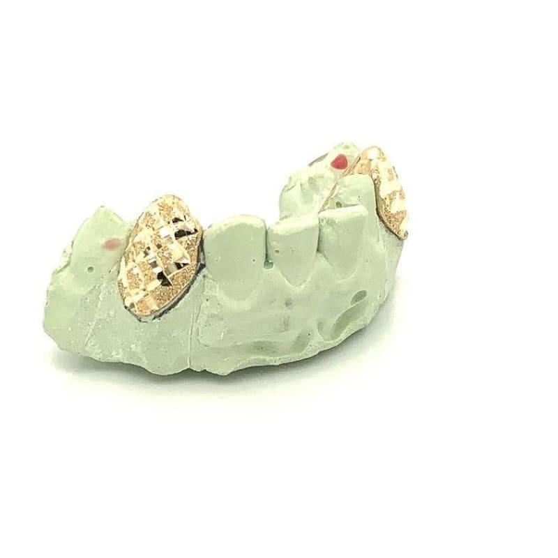 2pc Gold Snowflake Bottom Fangs - Seattle Gold Grillz