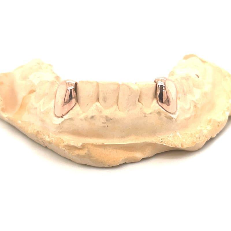 2pc Rose Gold Bottom Fangs - Seattle Gold Grillz