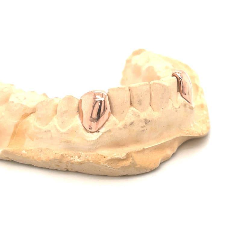 2pc Rose Gold Bottom Fangs - Seattle Gold Grillz