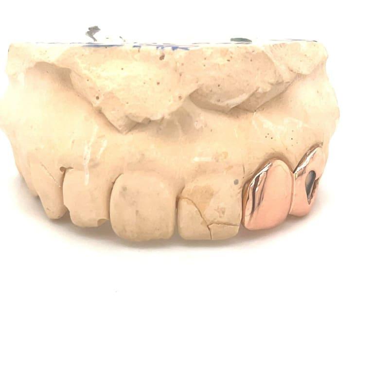 2pc Rose Gold Open Face Grillz - Seattle Gold Grillz