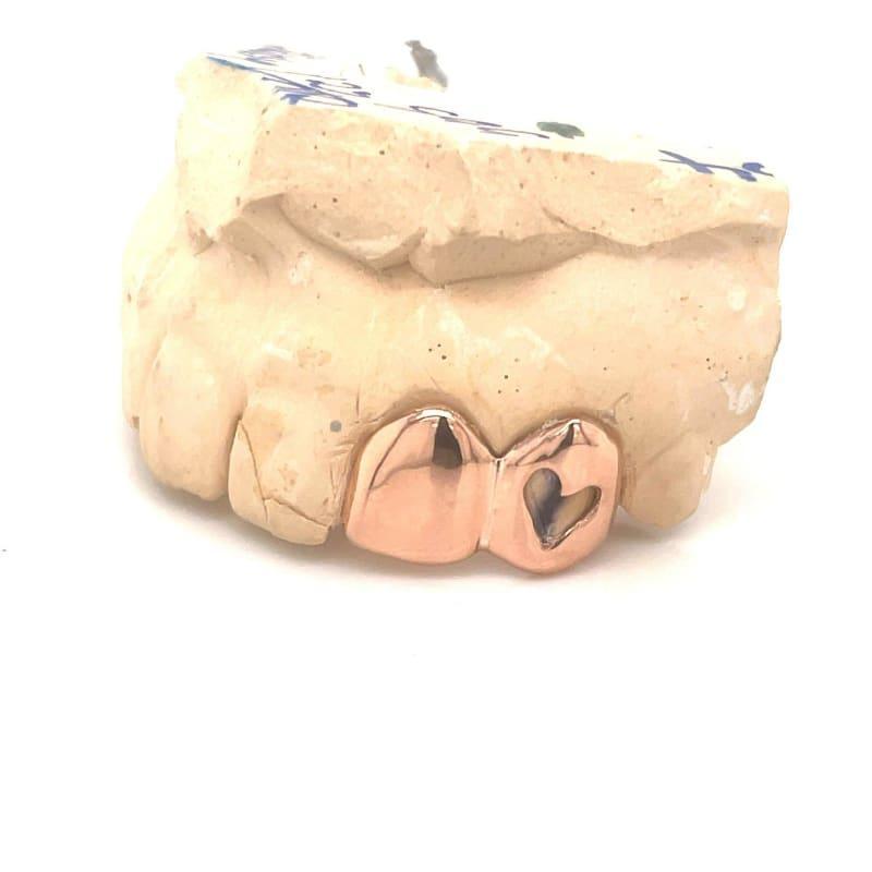 2pc Rose Gold Open Face Grillz - Seattle Gold Grillz