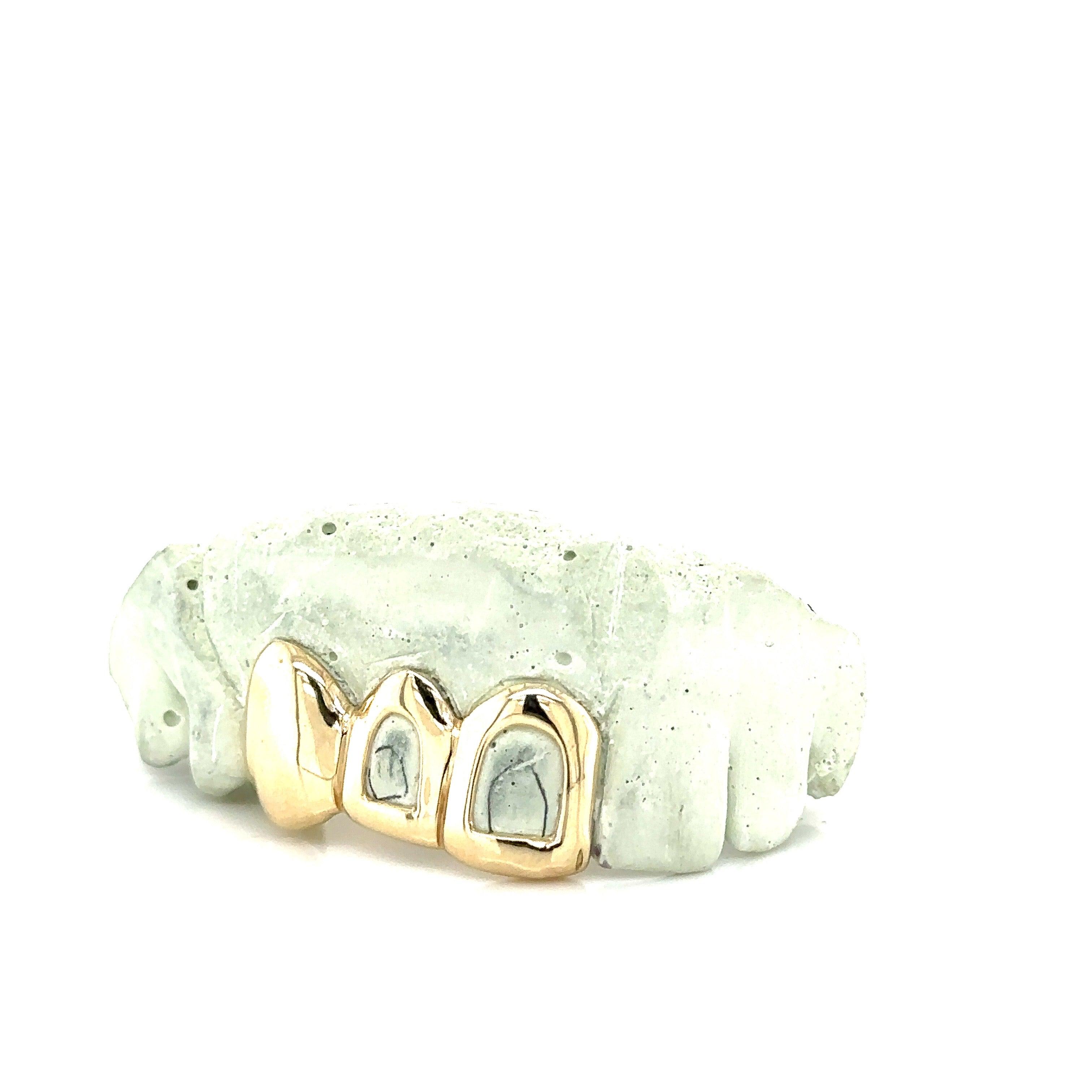 3pc Gold Open Face Top Grillz - Seattle Gold Grillz