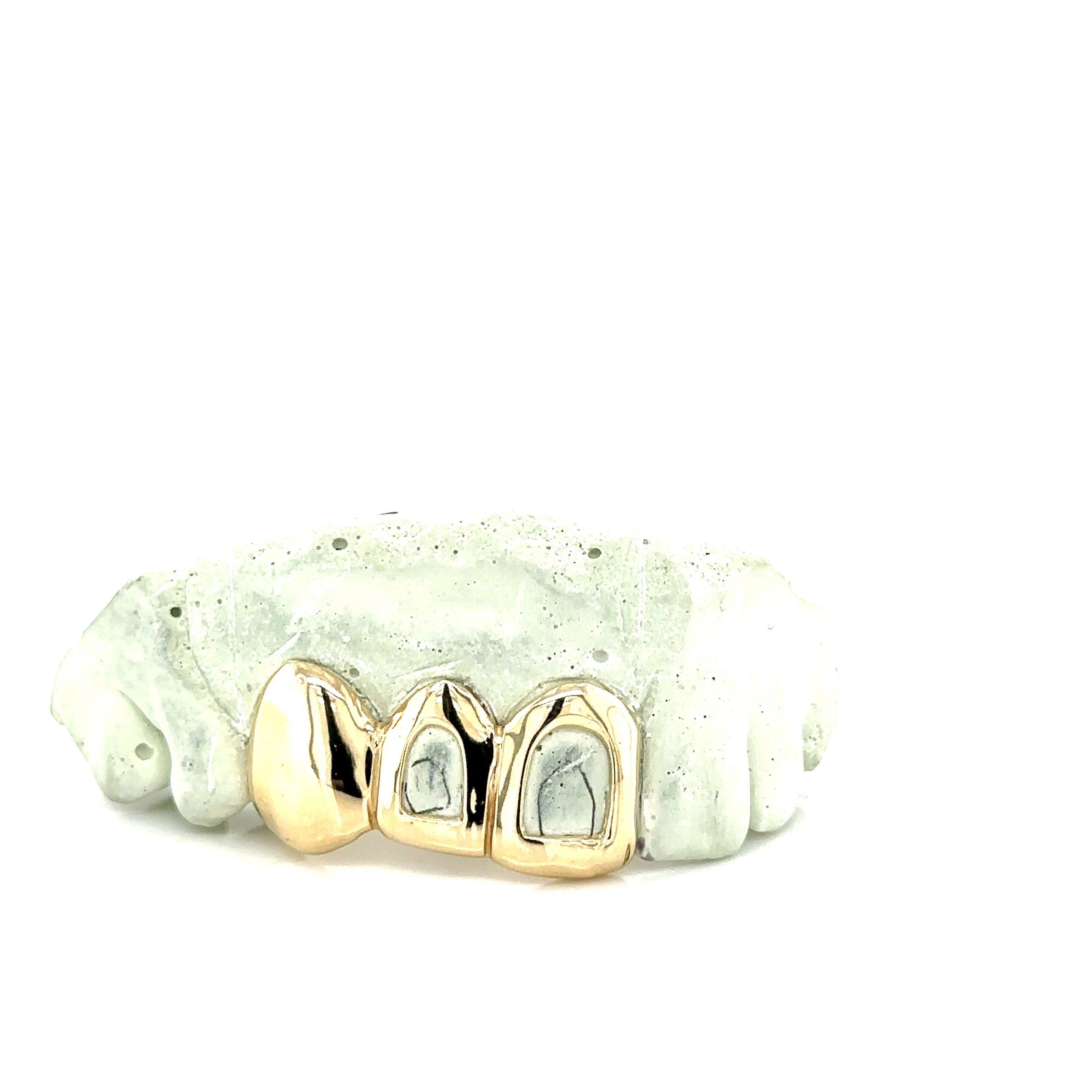 3pc Gold Open Face Top Grillz - Seattle Gold Grillz