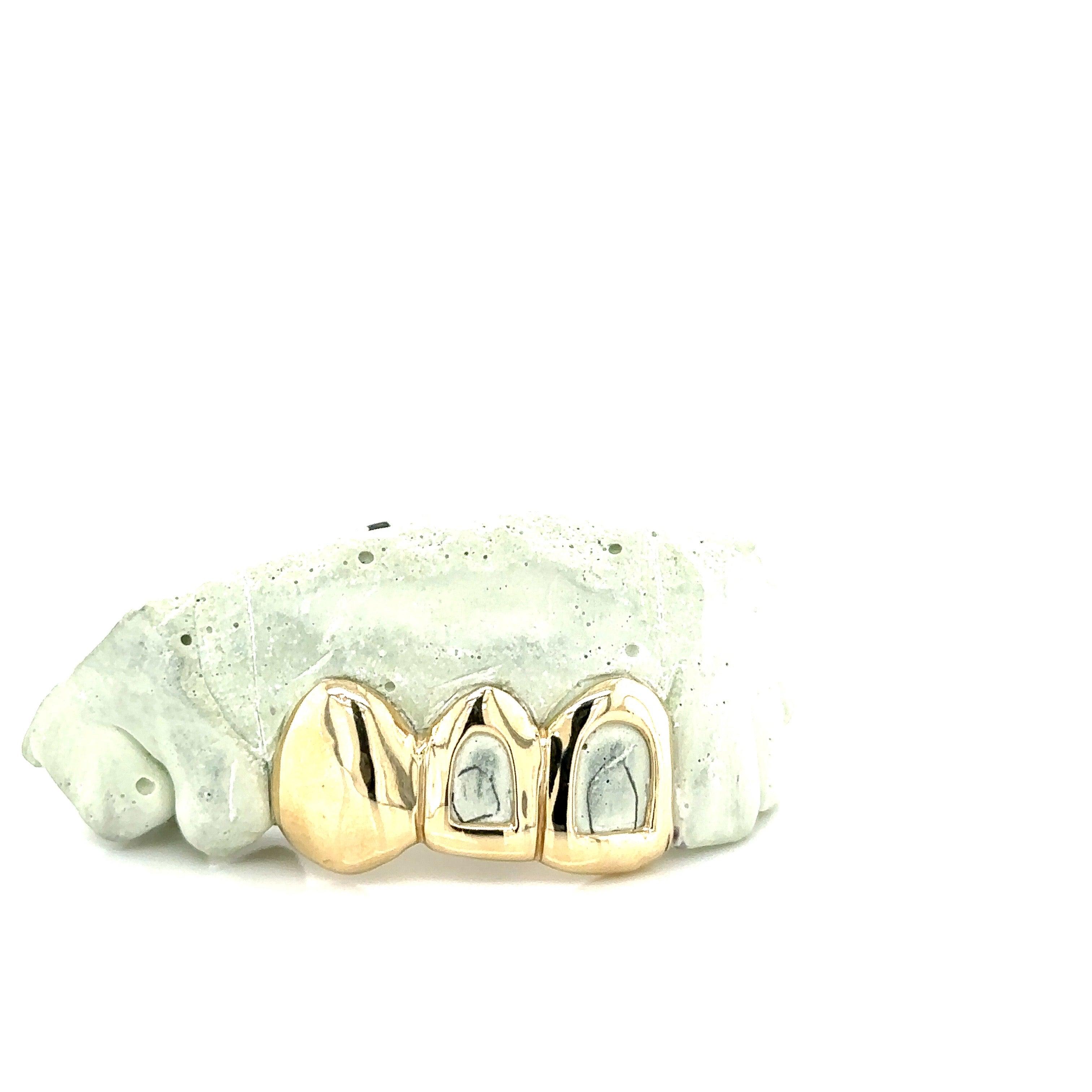 3pc Gold Open Face Top Grillz - Seattle Gold Grillz