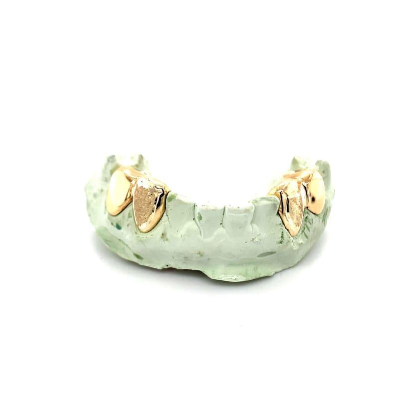 4pc Gold Diamond Dust Grillz - Seattle Gold Grillz
