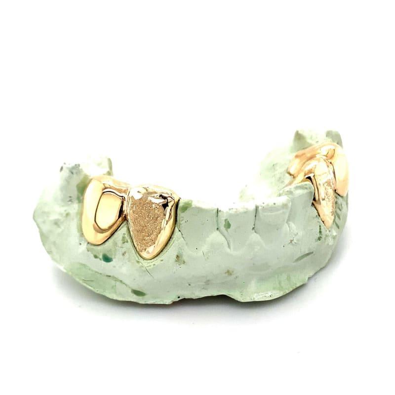 4pc Gold Diamond Dust Grillz - Seattle Gold Grillz