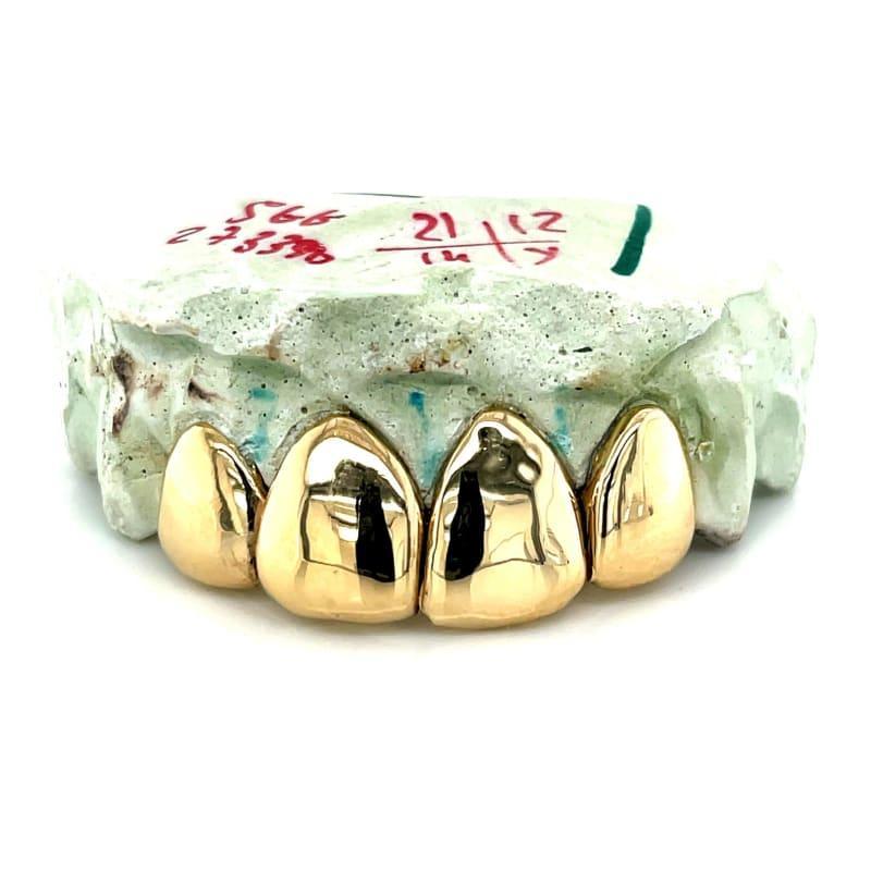 4pc Gold Perm Cut Grillz - Seattle Gold Grillz