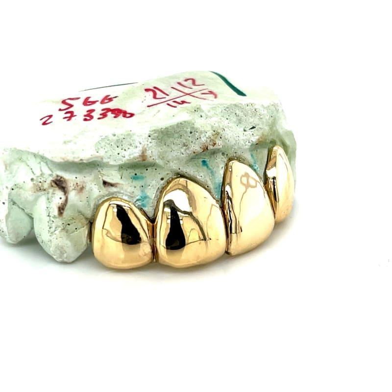 4pc Gold Perm Cut Grillz - Seattle Gold Grillz