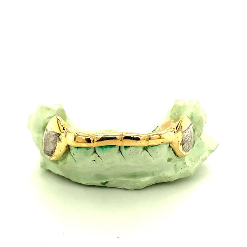 6pc Gold Dusted Bar Grillz - Seattle Gold Grillz
