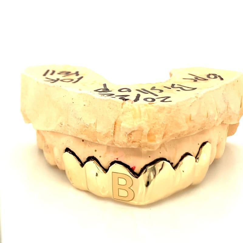 6pc Gold Initial Top Grillz - Seattle Gold Grillz
