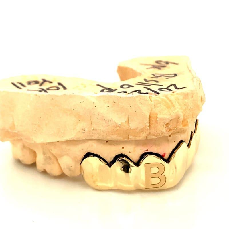 6pc Gold Initial Top Grillz - Seattle Gold Grillz