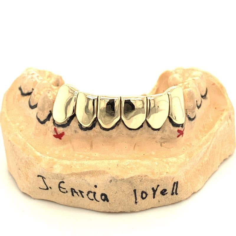 6pc Gold Perm Cut Bottom Grillz - Seattle Gold Grillz
