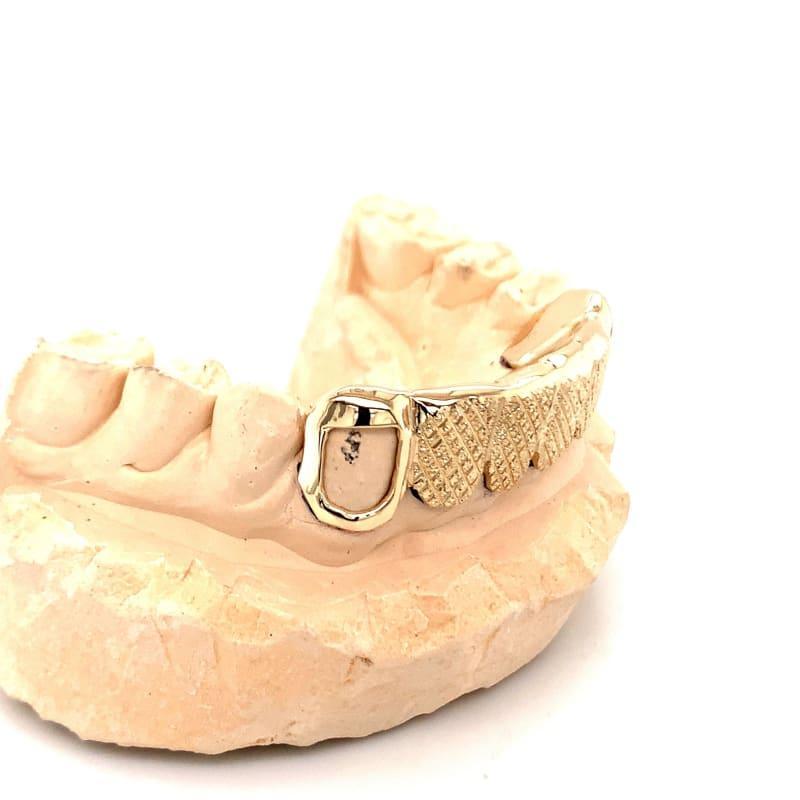 6pc Gold Snowflake Open Face Grillz - Seattle Gold Grillz