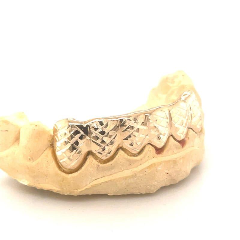 6pc Gold Trillion Cut Grillz - Seattle Gold Grillz