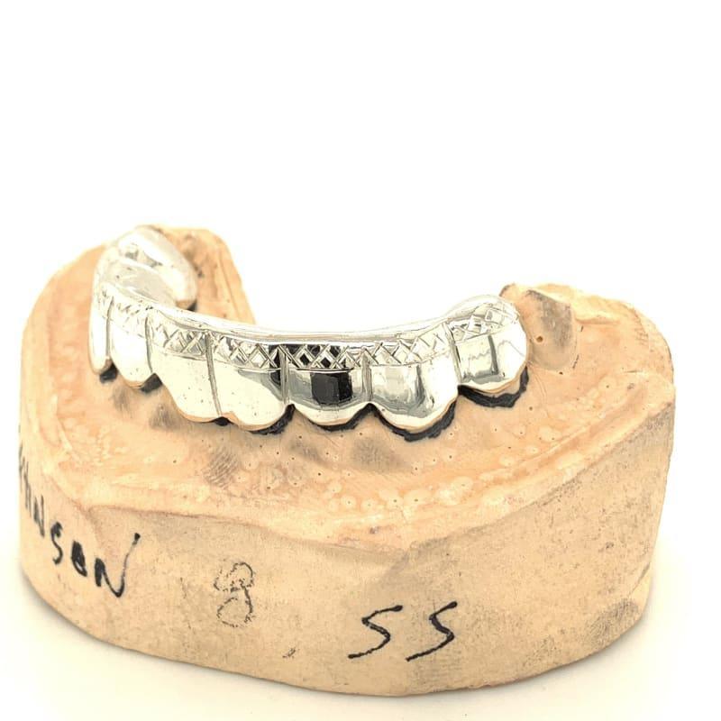 6pc Silver Trillion Tipped Grillz - Seattle Gold Grillz