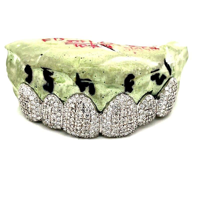 6pc White Gold Chandelier Diamond Grillz - Seattle Gold Grillz