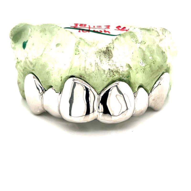 6pc White Gold Top Grillz - Seattle Gold Grillz