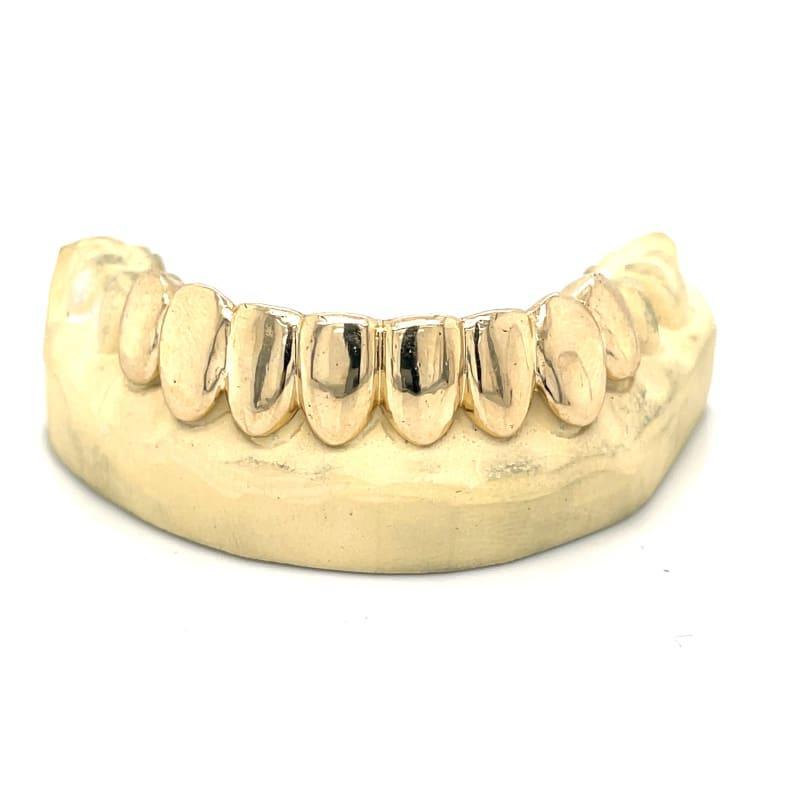 8pc Gold Bottom Grillz - Seattle Gold Grillz