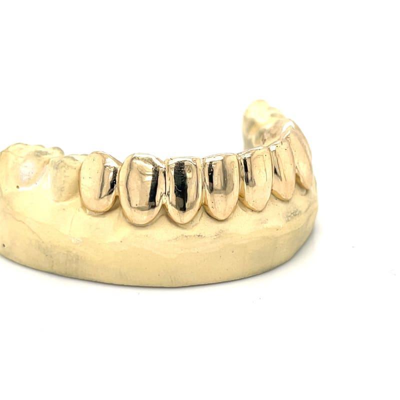 8pc Gold Bottom Grillz - Seattle Gold Grillz