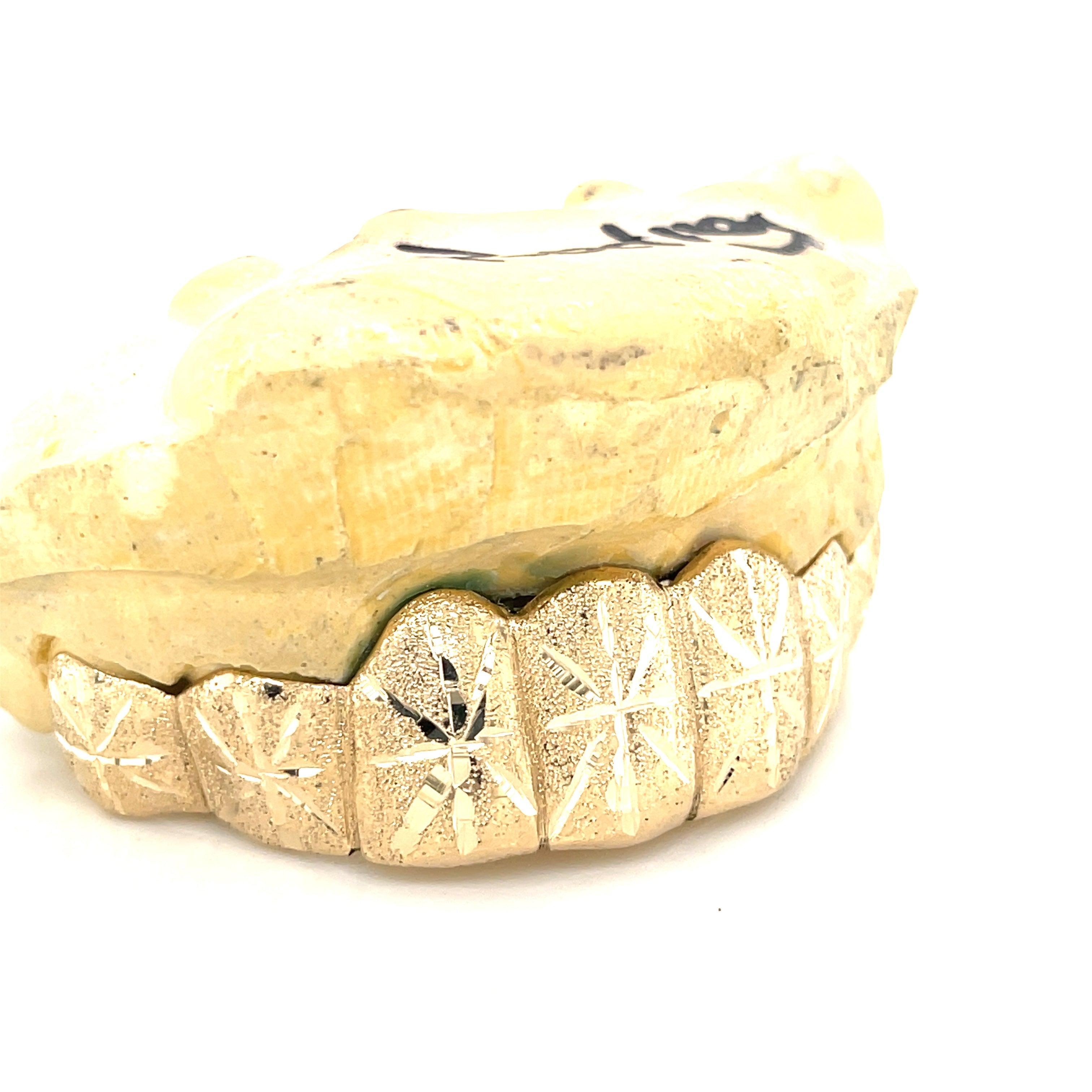 8pc Gold Snowfall Top Grillz - Seattle Gold Grillz