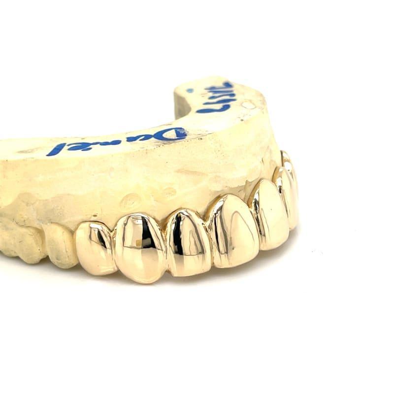 8pc Gold Top Grillz - Seattle Gold Grillz