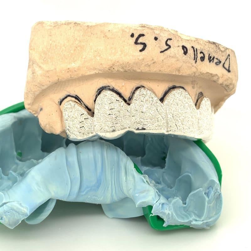 8pc Silver Gator Dusted Top Grillz - Seattle Gold Grillz