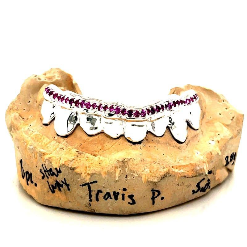 8pc Silver Ruby Tipped Grillz - Seattle Gold Grillz