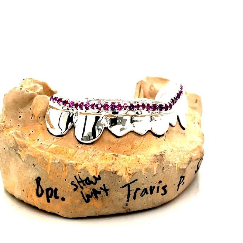 8pc Silver Ruby Tipped Grillz - Seattle Gold Grillz