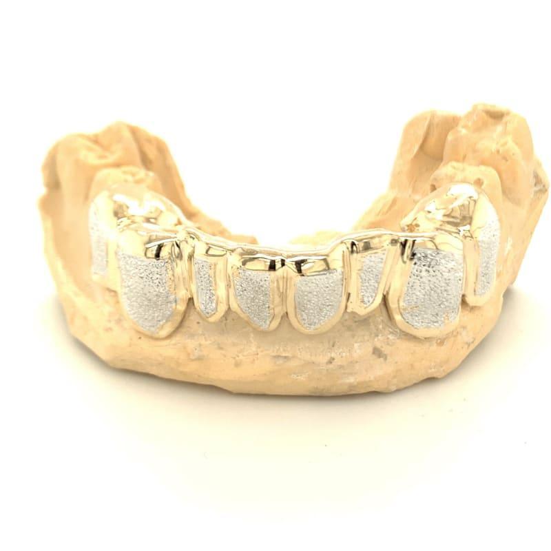8pc Two Tone Diamond Dust Bottom Grillz - Seattle Gold Grillz
