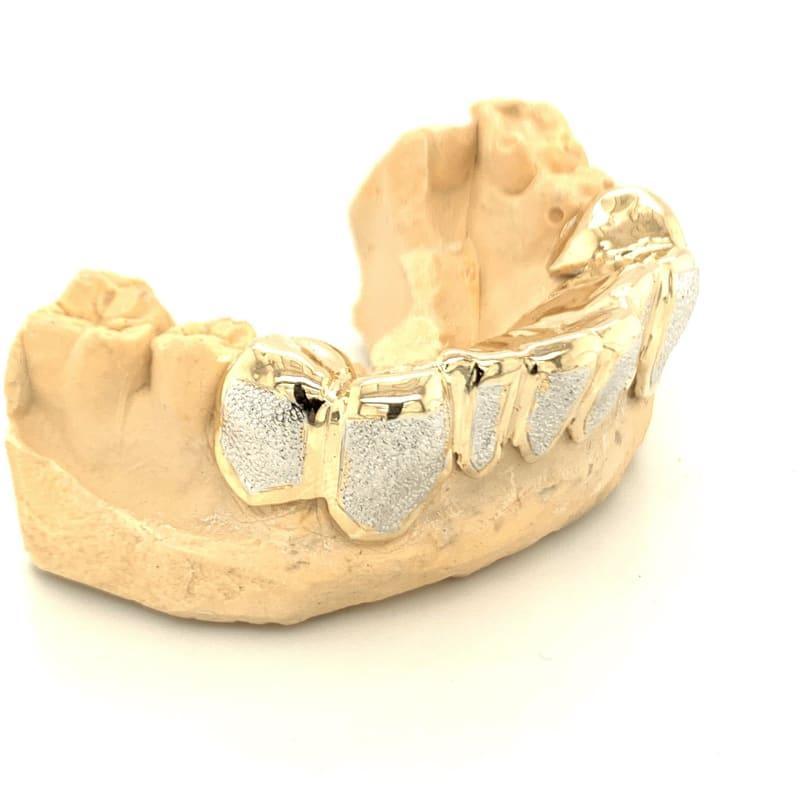 8pc Two Tone Diamond Dust Bottom Grillz - Seattle Gold Grillz