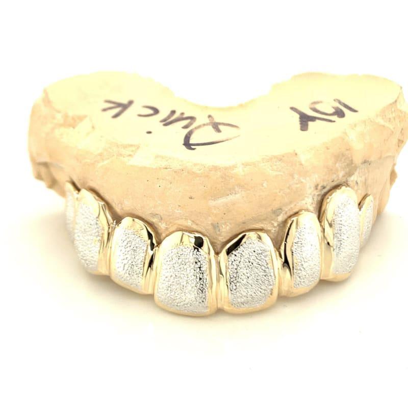 8pc Two Tone Dust Top Grillz - Seattle Gold Grillz
