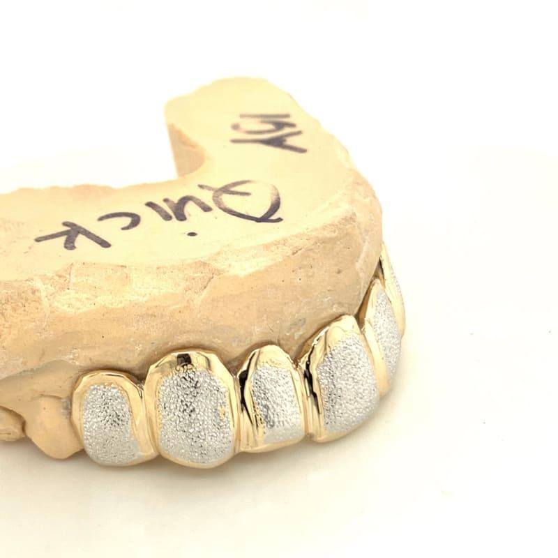 8pc Two Tone Dust Top Grillz - Seattle Gold Grillz