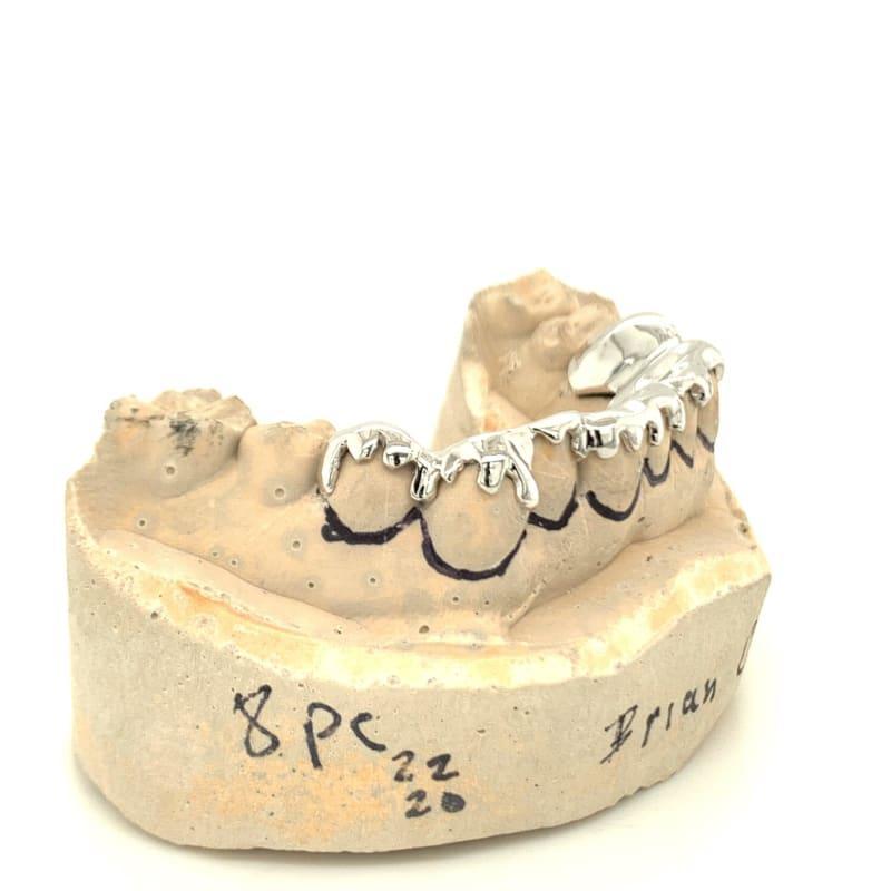 8pc White Gold Drip Bottom Grillz - Seattle Gold Grillz